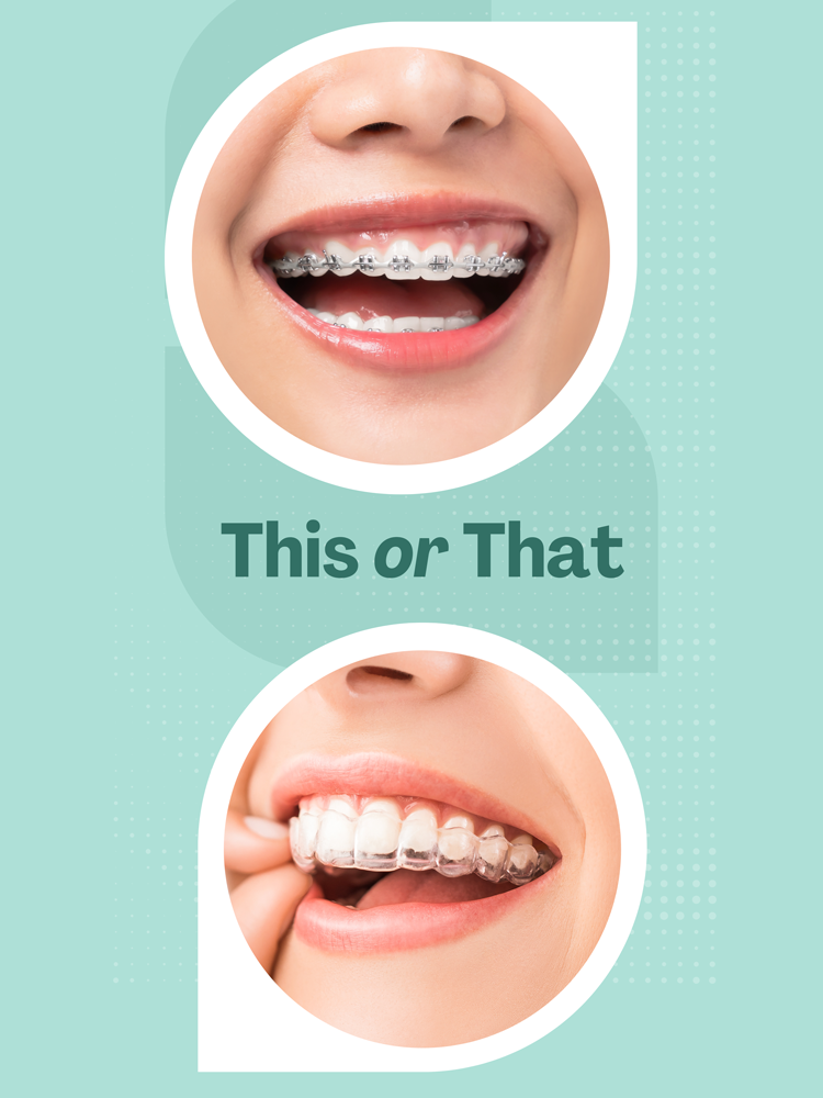 Which is Better: Braces or Invisalign?